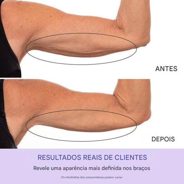 Firmeza Soul: O Tratamento Queridinho das Influencers para Braços Firmes sem Esforço! - SOULFITT
