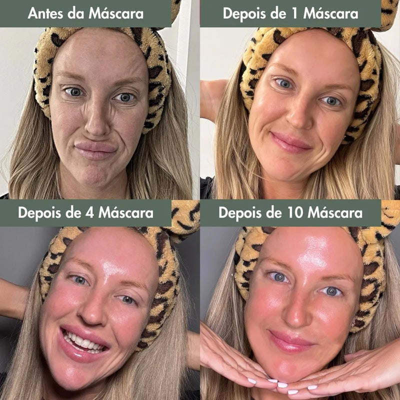 DermaGlow Botox+ - Máscara de colágeno + Ativo Botox - SOULFITT