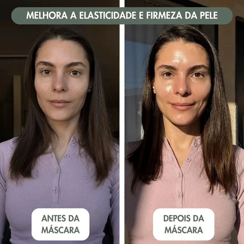 DermaGlow Botox+ - Máscara de colágeno + Ativo Botox - SOULFITT