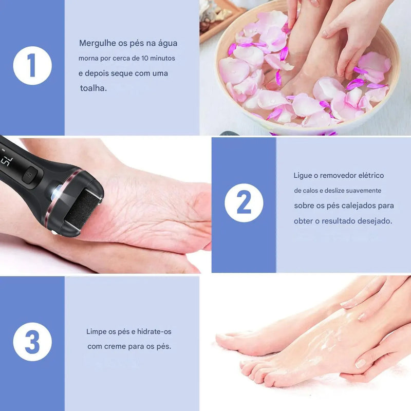 PedicurePro Elétrico – Cuide dos Seus Pés com Conforto e Praticidade em Casa - SOULFITT
